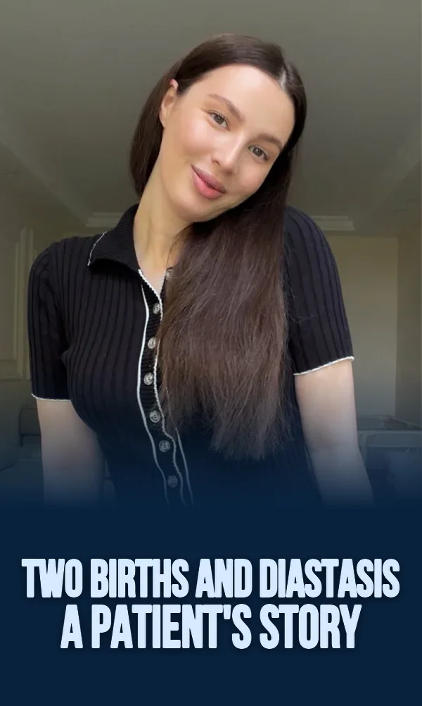 A patient's story: two births and diastasis