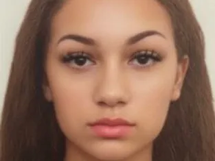 Bhad Bhabie and her rhinoplasty: what she posted, day by day