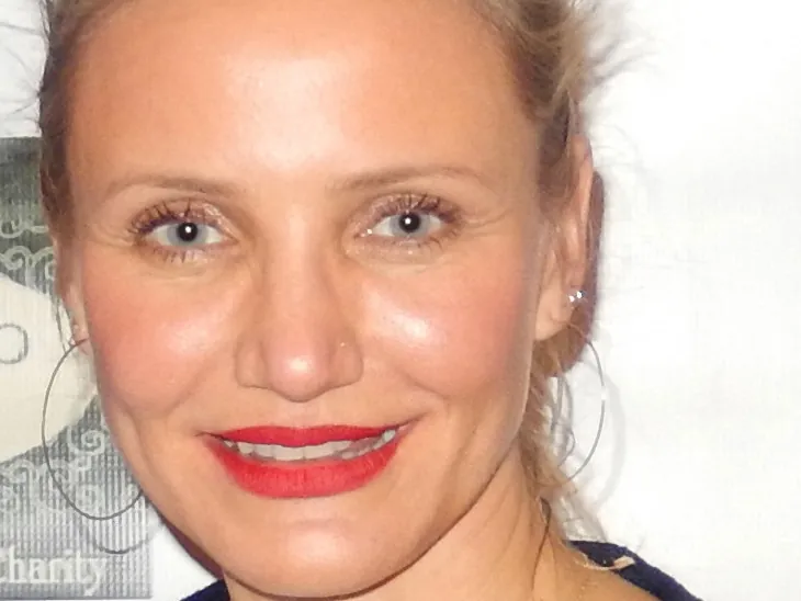 Did Cameron Diaz have a nose operation? Yes — and she called it purely medical