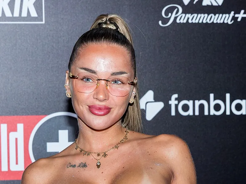 Did Emmy Russ have liposuction? Yes, and she explained why herself