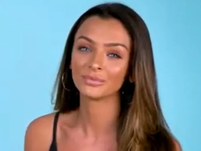 Kady McDermott on her “secret” nose job: “That feeling when you get your nose cast off”