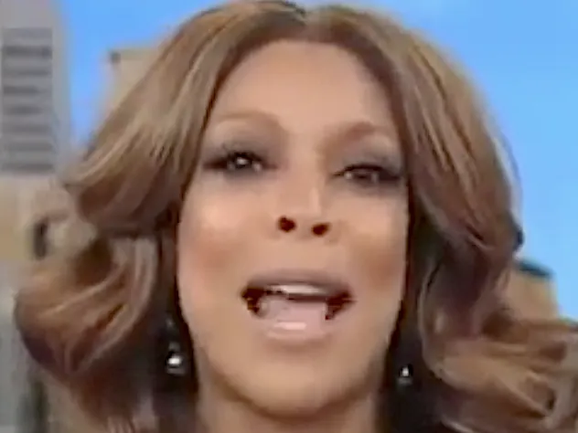 Did Wendy Williams have liposuction? Yes — and she paid a price for saying so
