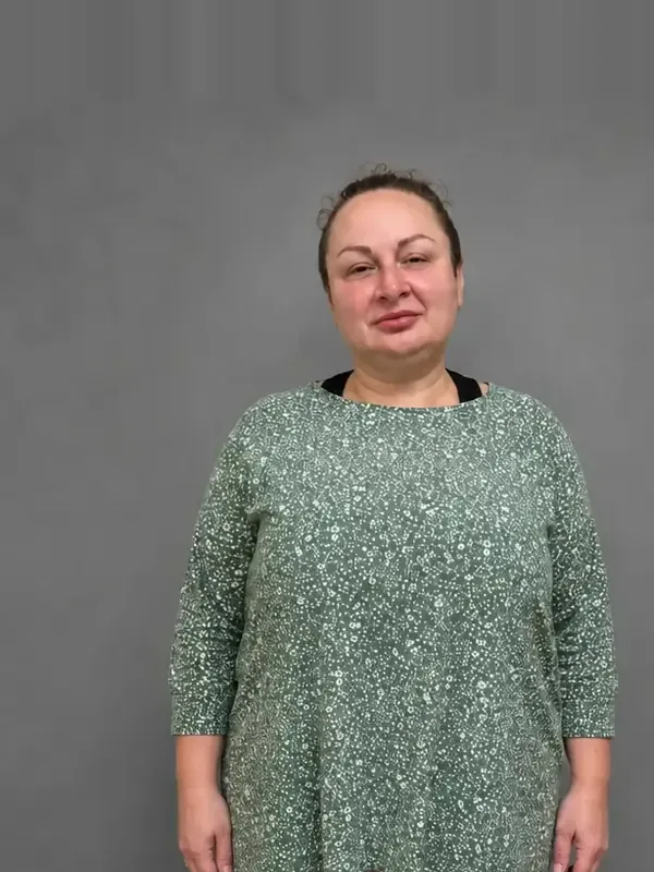 Резултати на нашите пациенти: Преди