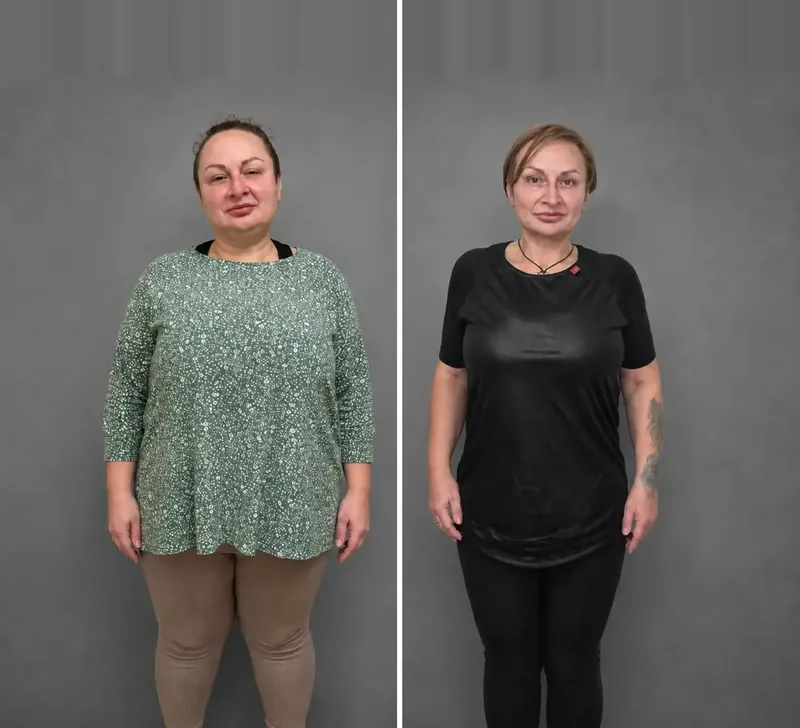 Résultats de nos patients: Avant / Après