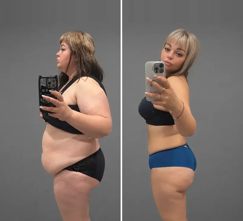 Resultados dos nossos pacientes: Antes / Depois