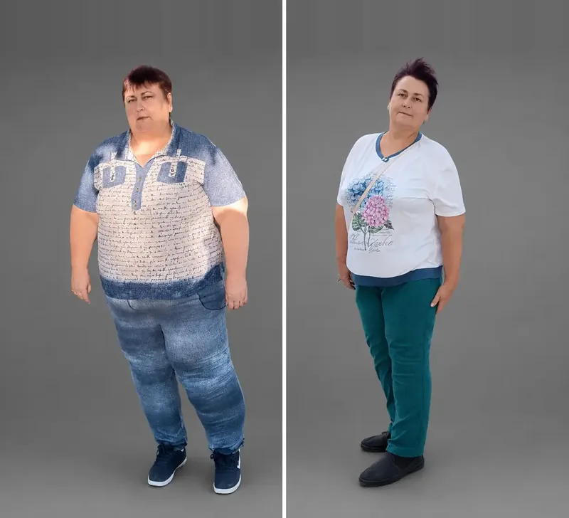 Results of our patients: Before / After