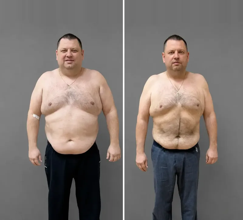 Results of our patients: Before / After