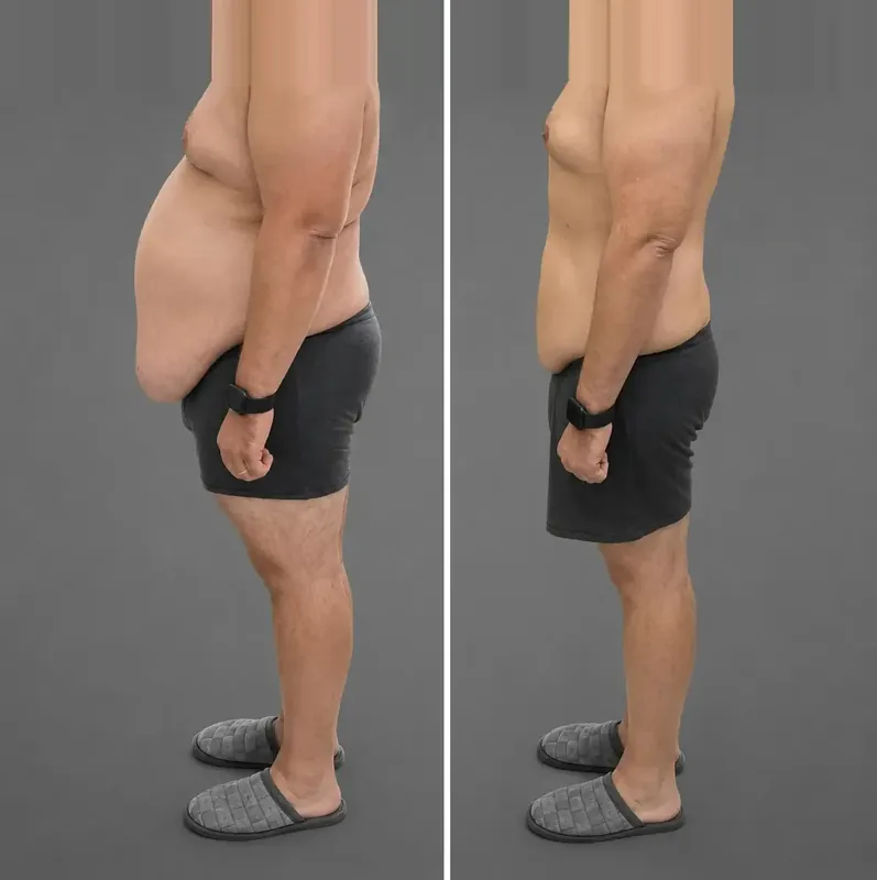 Results of our patients: Before / After