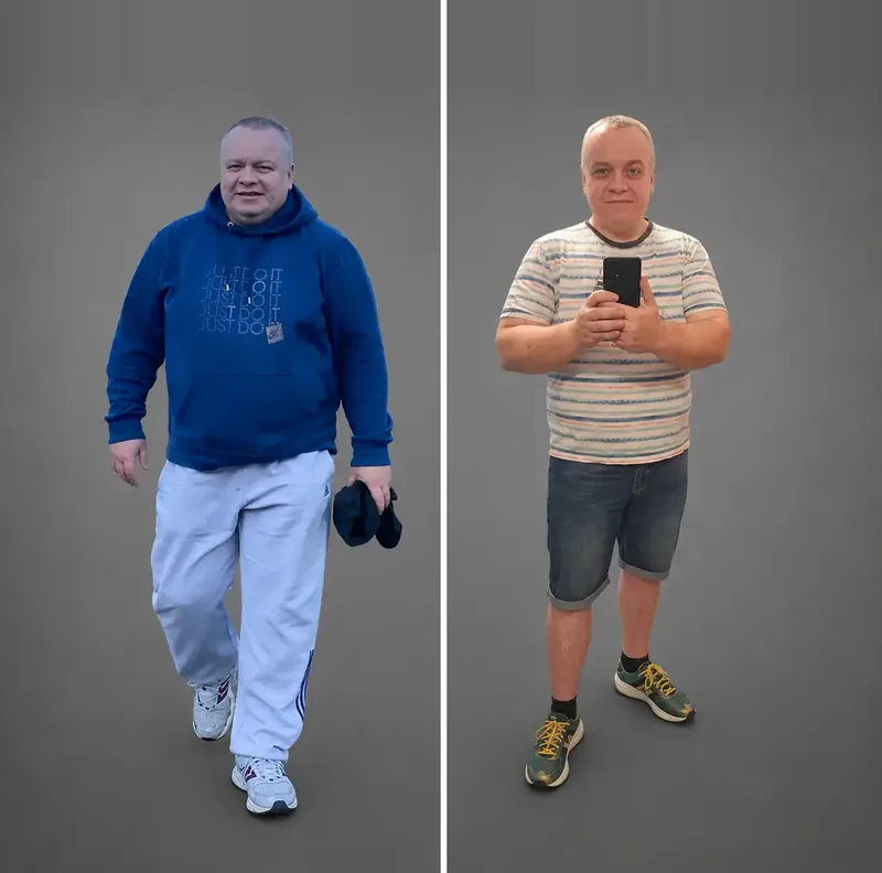 Results of our patients: Before / After