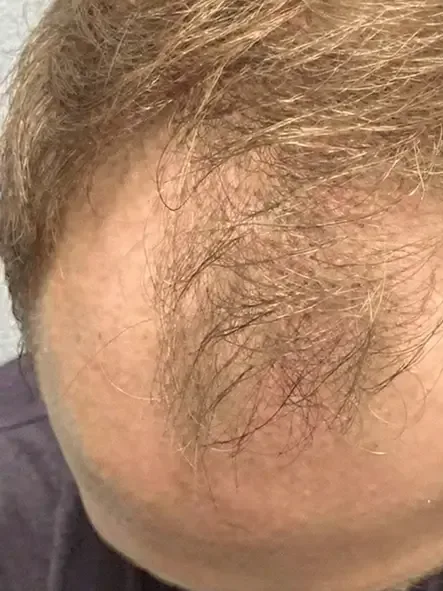Резултати на нашите пациенти: Преди