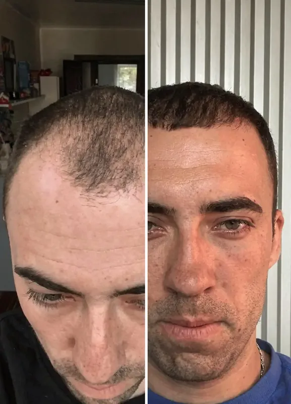 Resultados dos nossos pacientes: Antes / Depois