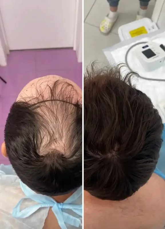 Resultados dos nossos pacientes: Antes / Depois