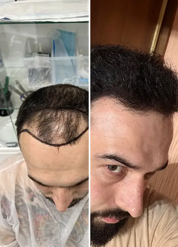 نتائج مرضانا: قبل / بعد