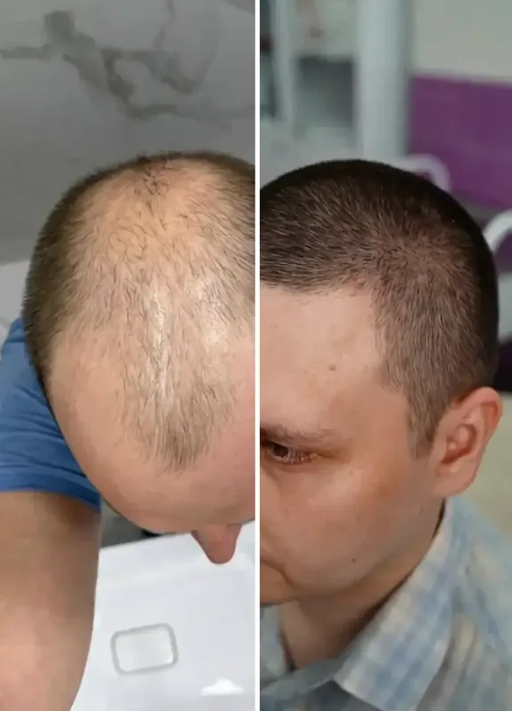 نتائج مرضانا: قبل / بعد