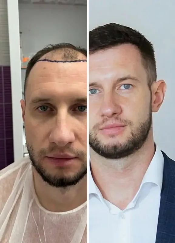 نتائج مرضانا: قبل / بعد