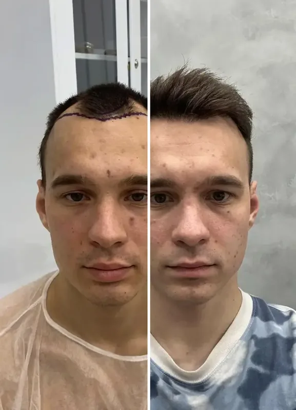 Rezultati naših pacijenata: Prije / Poslije