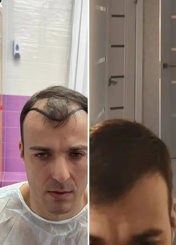 Efekty naszych pacjentów: Przed / Po