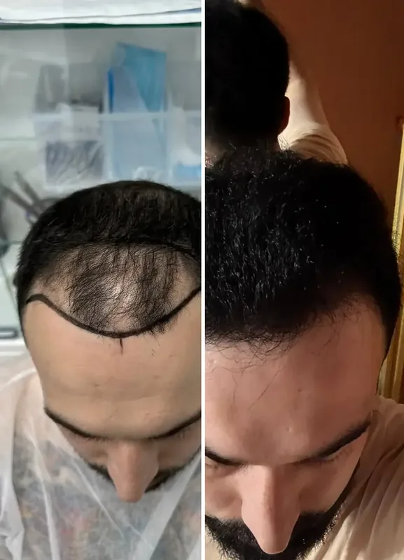 Výsledky našich pacientů: Před / Po
