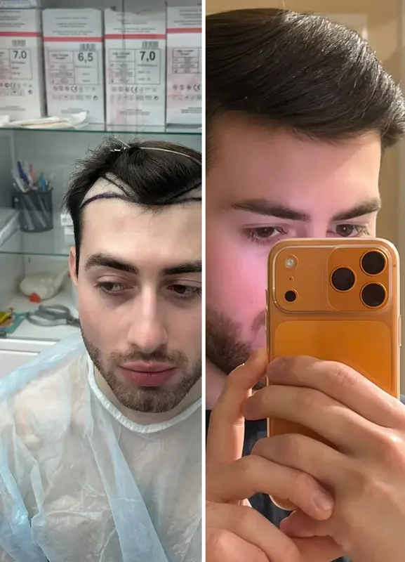 Výsledky našich pacientů: Před / Po