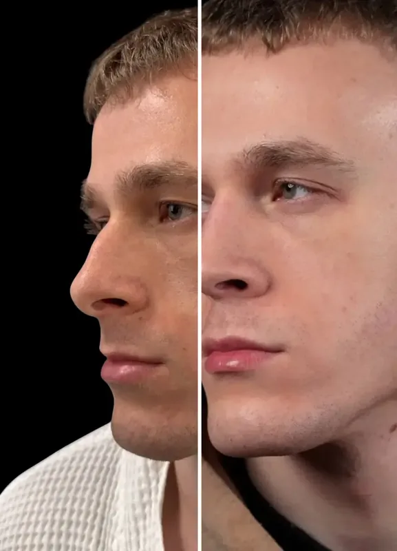 Výsledky našich pacientů: Před / Po