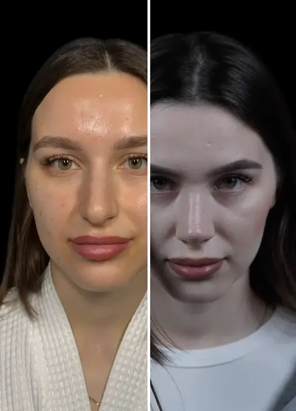 Резултати наших пацијената: Пре / После