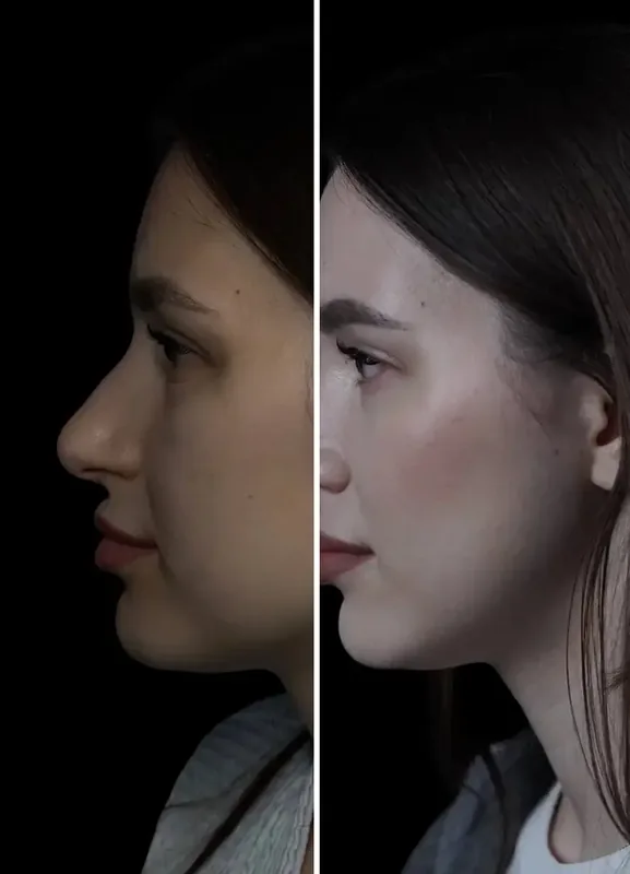 Resultados dos nossos pacientes: Antes / Depois