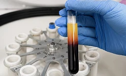 A blood sample for tests before mammoplasty
