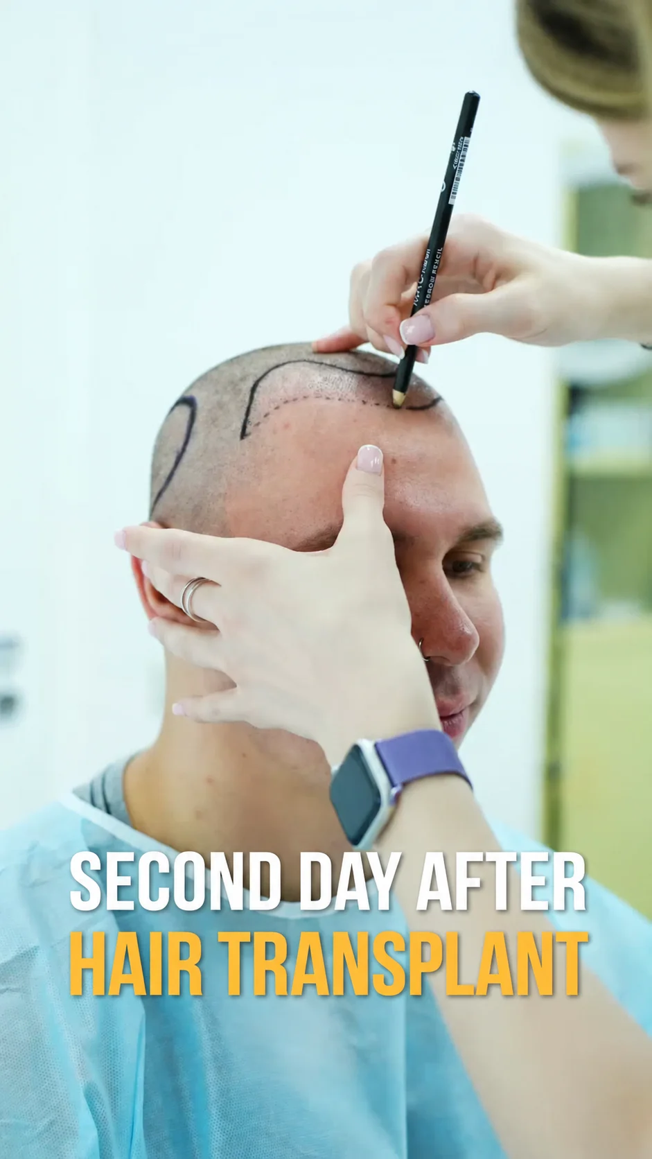 Video about hair transplants at City Medical Centre, clip 14