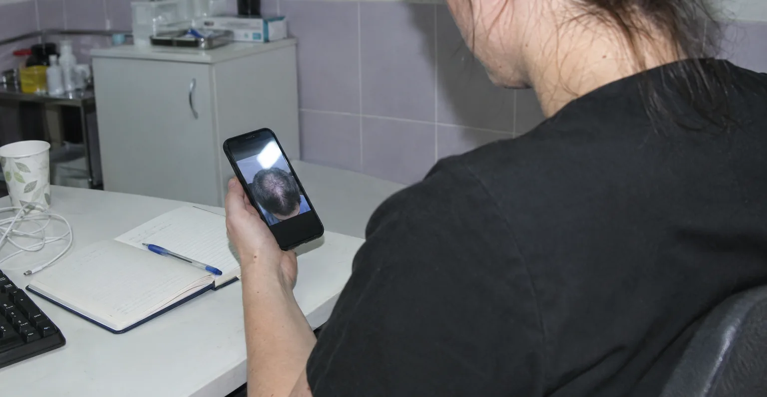 A doctor looking at a photo of a thinning area on a phone