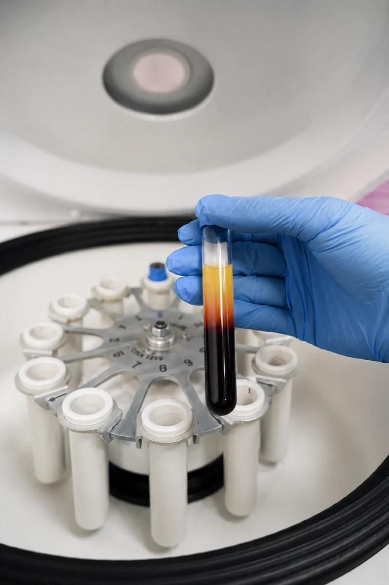 A blood sample for tests before surgery