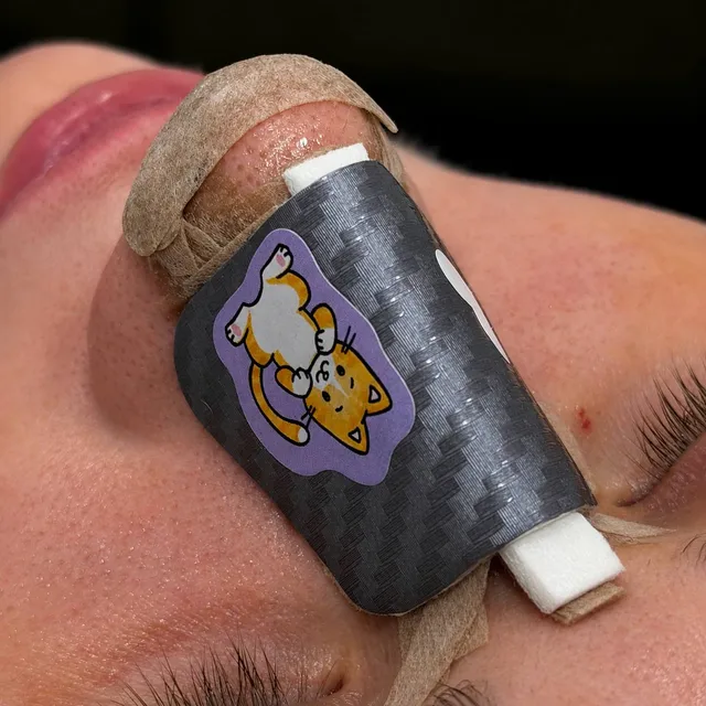 A patient after rhinoplasty: carbon-look splint with a cat