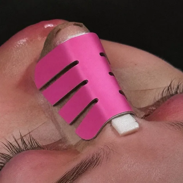 A patient after rhinoplasty: raspberry splint