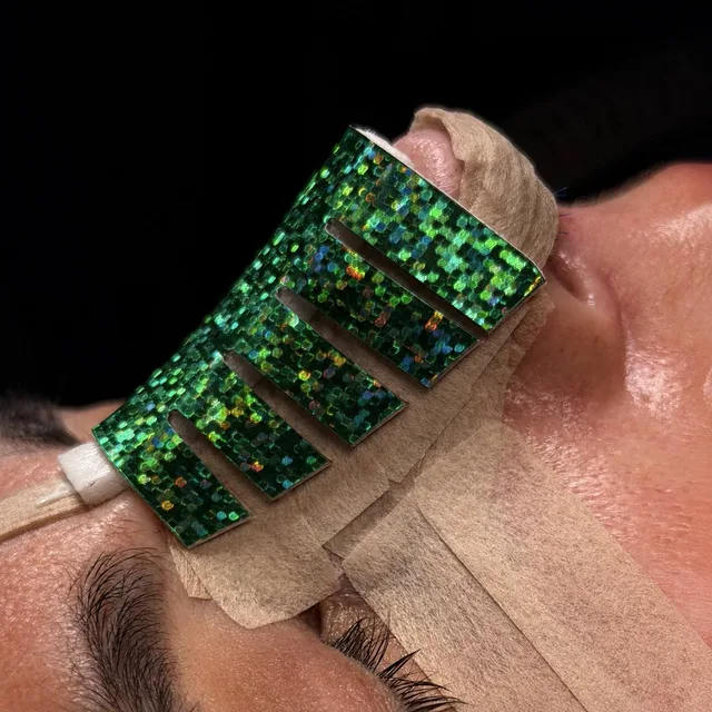 A patient after rhinoplasty: green holographic splint