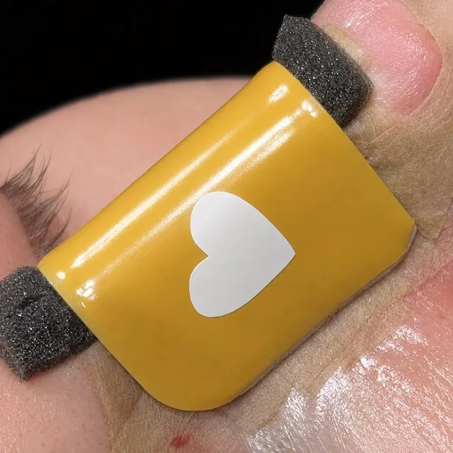 A patient after rhinoplasty: yellow splint with a heart