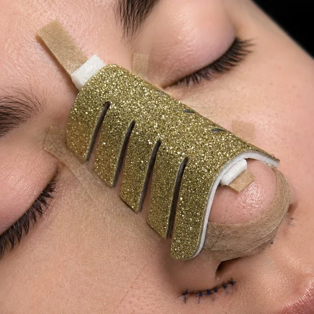 A patient after rhinoplasty: gold glitter splint