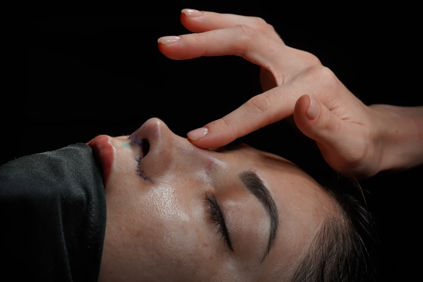 A doctor checks a patient's nose shape before rhinoplasty