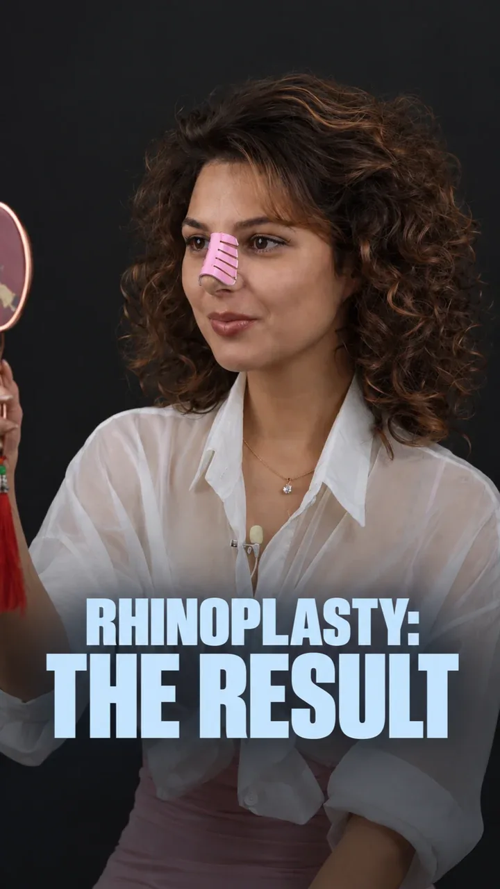 Patient with a mirror after rhinoplasty: the result