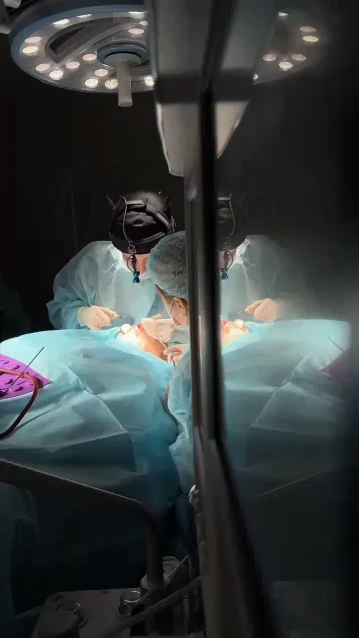 Patient before rhinoplasty in the operating room
