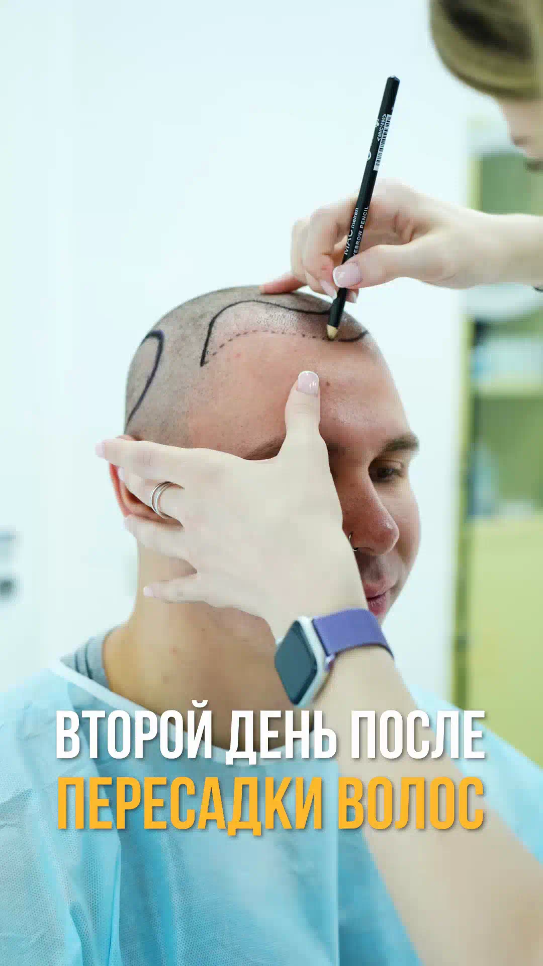 Video about hair transplants at City Medical Centre, clip 14